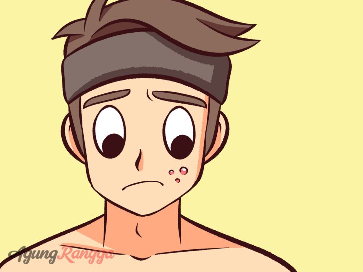 Kulit Berminyak Identik dengan Jerawat? Inilah yang Harus Anda Lakukan!